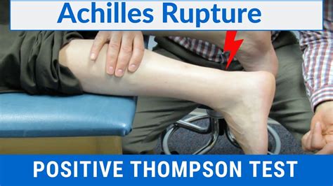 test to check for achilles tendon tear|thompson test positive or negative.